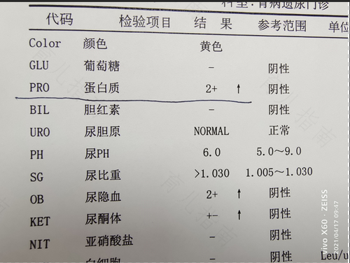 小便少怎么办 小便少怎么办