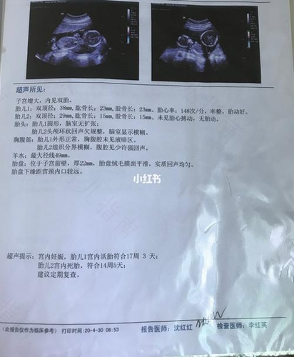 发生胎停育 今后怎么办? 发生胎停育 今后怎么办?