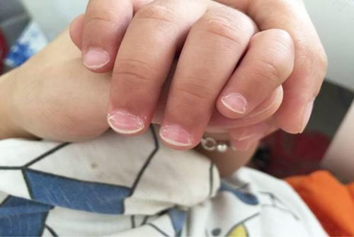 宝宝老啃手指怎么回事 宝宝老啃手指怎么回事