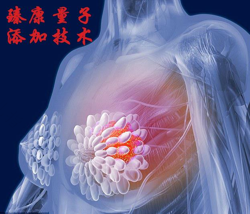 副乳肿胀疼痛怎么办 副乳肿胀疼痛怎么办