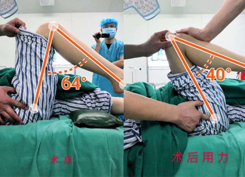 膝关节韧带粘连怎么办 膝关节韧带粘连怎么办