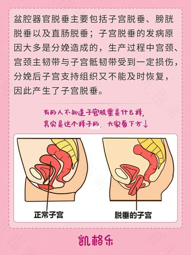 打了子宫收缩针,肚子会痛几天 打了子宫收缩针,肚子会痛几天