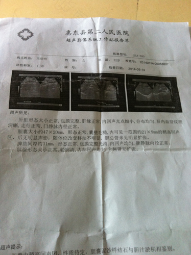 胆囊胆汁淤积怎么办一直疼 胆囊胆汁淤积怎么办一直疼