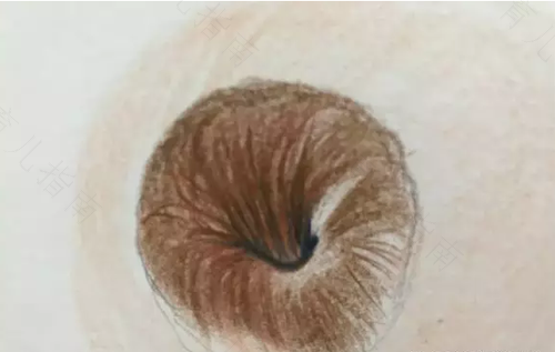 没有乳头的原因是什么去那个医院看 没有乳头的原因是什么去那个医院看