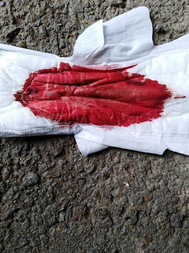 例假血颜色浅是怎么回事