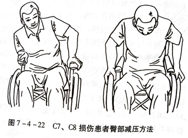 屁股神经拉伤了怎么办 屁股神经拉伤了怎么办