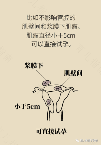 子宫前壁有个小肌瘤严重吗