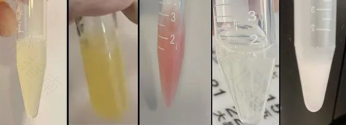 精子味道很浓很臭为什么 精子味道很浓很臭为什么