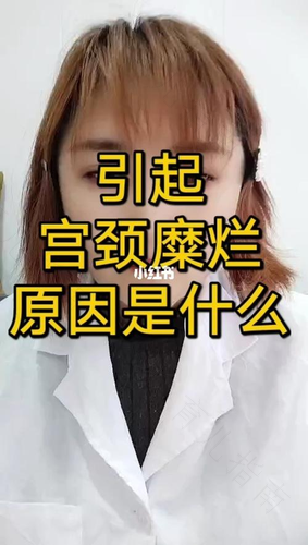女性宫颈糜烂是什么原因引起的 女性宫颈糜烂是什么原因引起的