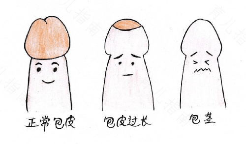 龟头里面疼是怎么回事