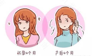 产后新妈如何科学应对脱发
