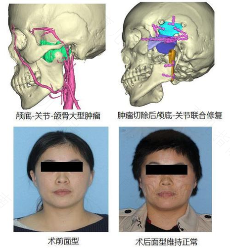 造成儿童颌面缺陷的原因