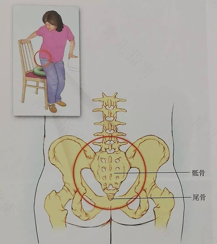 单侧臀大肌疼痛怎么回事 单侧臀大肌疼痛怎么回事