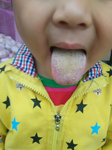 宝宝发烧后舌苔厚白怎么办 宝宝发烧后舌苔厚白怎么办