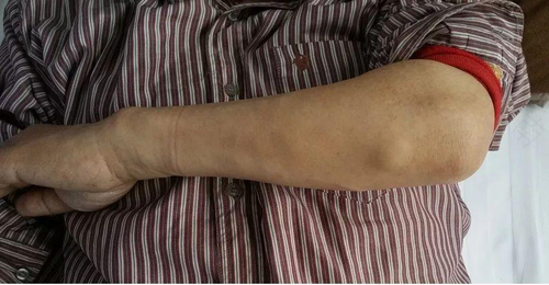 风湿和类风湿的区别是什么? 风湿和类风湿的区别是什么?