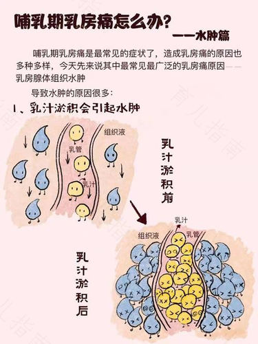 乳头有时候会痛是什么原因 乳头有时候会痛是什么原因