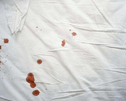 子宫体癌的症状是什么 子宫体癌的症状是什么