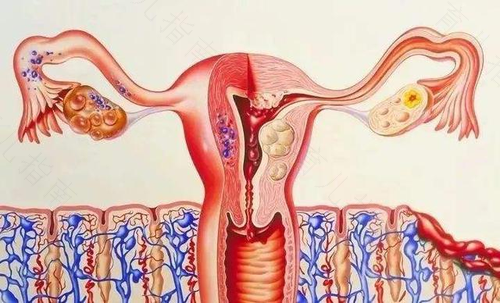 子宫内膜薄应该注意什么事项 子宫内膜薄应该注意什么事项