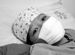 儿童白血病什么原因引起的 儿童白血病什么原因引起的