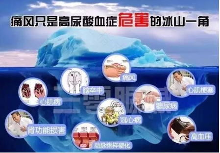 尿酸低能得痛风吗? 尿酸低能得痛风吗?