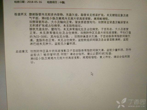 盆腔炎要做什么检查确诊 盆腔炎要做什么检查确诊