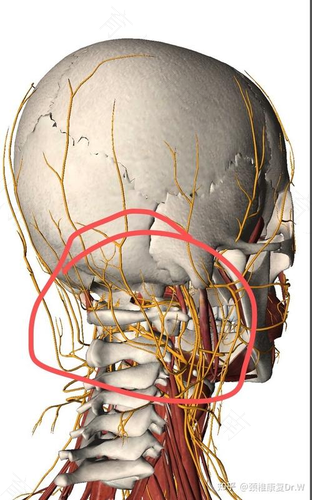 如何判断头痛是颈椎病引起的 如何判断头痛是颈椎病引起的
