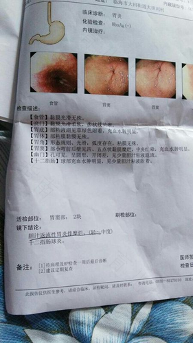 感冒可以做胃镜吗?