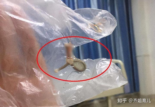 绝经后节育器不取出来有危害吗 绝经后节育器不取出来有危害吗