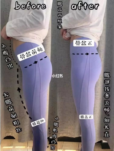 如何矫正骨盆前倾 如何矫正骨盆前倾