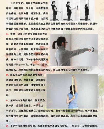 做什么运动可以缓解肩周炎 做什么运动可以缓解肩周炎