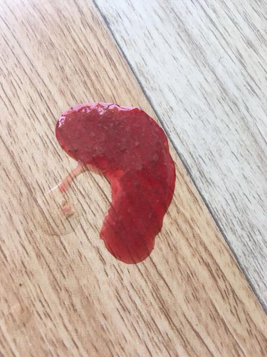 大便深红色是怎么回事啊 大便深红色是怎么回事啊