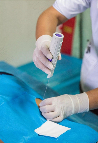 什么情况要做肾穿刺? 什么情况要做肾穿刺?