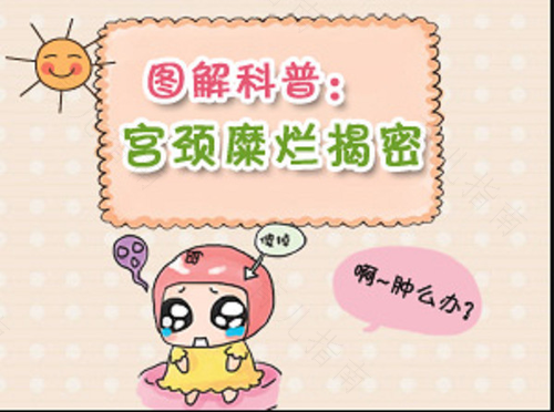 什么是宫颈糜烂样改变? 什么是宫颈糜烂样改变?