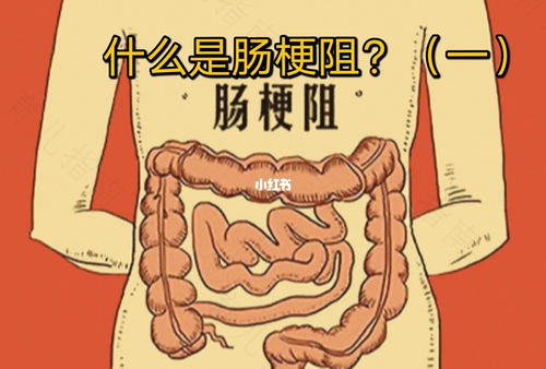 肠鸣音亢进一分钟几次 肠鸣音亢进一分钟几次