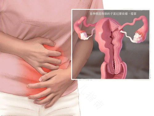 子宫里面疼是怎么回事 子宫里面疼是怎么回事
