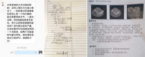 宫颈纳囊需要做手术吗 宫颈纳囊需要做手术吗