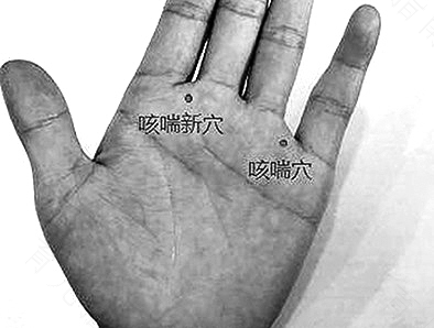 咳嗽按手哪个部位能止咳 咳嗽按手哪个部位能止咳