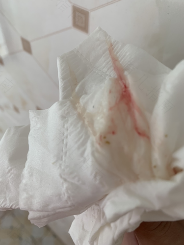 见红偶尔肚子痛怎么办 见红偶尔肚子痛怎么办