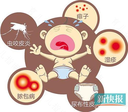 警惕！夏日3疾病易骚扰BB