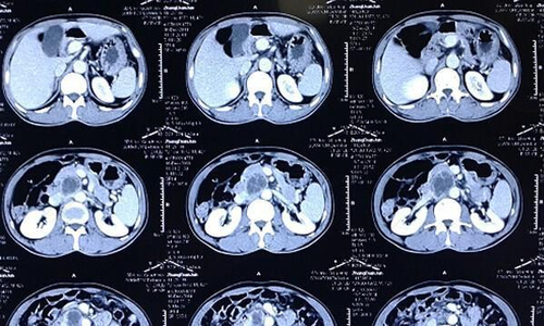 x光和b超的区别