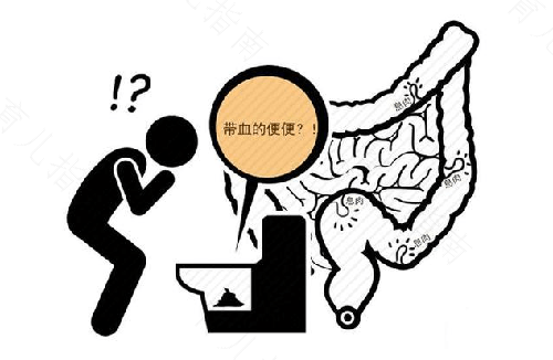 幼儿经常腹泻是怎么回事 幼儿经常腹泻是怎么回事