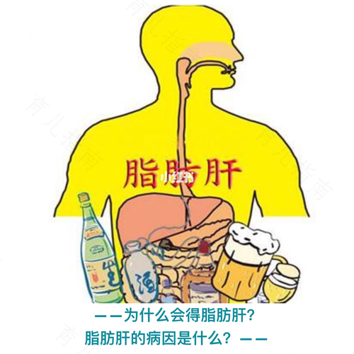 肥胖有脂肪肝怎么办 肥胖有脂肪肝怎么办