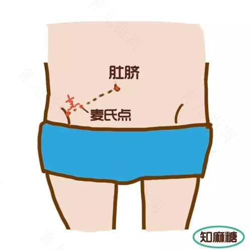 肚脐眼按压疼怎么回事女性
