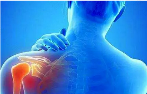 肩周炎怎么治疗缓解疼痛 肩周炎怎么治疗缓解疼痛