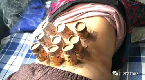 宫颈肥大可以艾灸吗 宫颈肥大可以艾灸吗