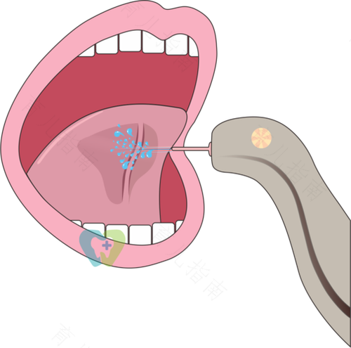 婴儿有点连舌什么时候剪好 婴儿有点连舌什么时候剪好