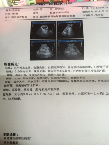 肾脏彩超能检查出肾炎吗 肾脏彩超能检查出肾炎吗