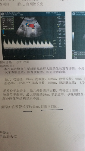 宫颈管长有什么影响吗 宫颈管长有什么影响吗