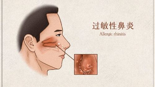 过敏性鼻炎做手术有后遗症吗 过敏性鼻炎做手术有后遗症吗