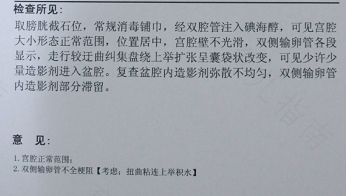 彩超能查出宫颈粘连吗 彩超能查出宫颈粘连吗